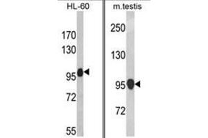 (LEFT) Western blot analysis of NLRP12 Antibody in HL-60 cell line lysates (35ug/lane).