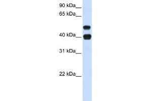 WB Suggested Anti-USP22 Antibody Titration: 0. (USP22 抗体  (N-Term))