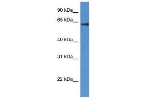 Western Blot showing FLCN antibody used at a concentration of 1 ug/ml against Fetal Heart Lysate (FLCN 抗体  (N-Term))