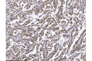 IHC analysis of JHDM3A/JMJD2A/KDM4A using anti-JHDM3A/JMJD2A/KDM4A antibody (ABIN7601534).