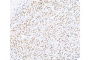 anti-Runt-Related Transcription Factor 2 (RUNX2) (AA 300-350) antibody