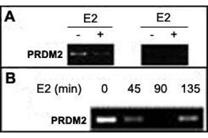 A : Soluble chromatin was prepared from MCF-7 cells not treated or treated with E2 for 45 min. (PRDM2 抗体  (AA 1-347))