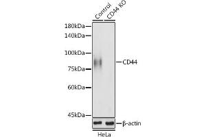 Western blot analysis of extracts of HeLa cells, using CD44 antibody (ABIN6127602, ABIN6138193, ABIN6138195 and ABIN7101398) at 1:1000 dilution. (CD44 抗体  (AA 148-247))