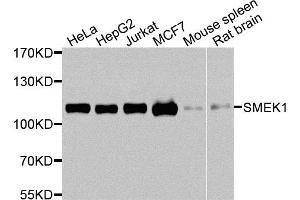 Western blot analysis of extracts of various cell lines, using SMEK1 antibody. (SMEK1 抗体)