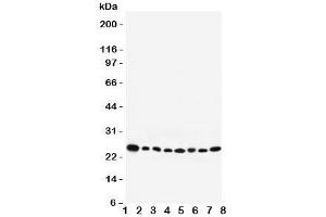 Western blot testing of Rab8 antibody and Lane 1:  rat brain;  2: mouse brain;  3: human placenta;  4: (h) HeLa;  5: (r) PC12;  6: (m) NIH3T3;  7: (h) A431;  8: (h) 293T lysate. (RAB8A 抗体  (C-Term))