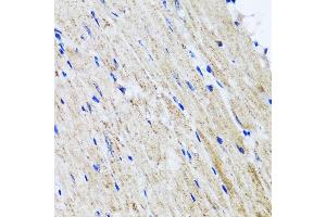 Immunohistochemistry of paraffin-embedded mouse heart using HY antibody  at dilution of 1:100 (40x lens). (HYAL1 抗体  (AA 136-435))