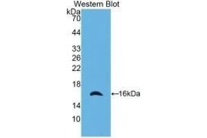 Western Blotting (WB) image for anti-CASP2 and RIPK1 Domain Containing Adaptor with Death Domain (CRADD) (AA 1-199) antibody (ABIN7426616)