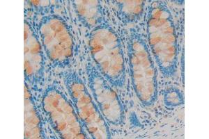 Used in DAB staining on fromalin fixed paraffin- embedded Kidney tissue (SDCBP 抗体  (AA 2-298))