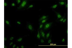 Image no. 3 for anti-Ribosomal Protein L9 (RPL9) (AA 93-192) antibody (ABIN598584) (RPL9 抗体  (AA 93-192))