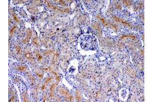 IHC analysis of CD105 using anti-CD105 antibody .