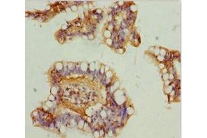 Immunohistochemistry of paraffin-embedded human small intestine tissue using ABIN7160913 at dilution of 1:100 (NDUFA9 抗体  (AA 1-270))
