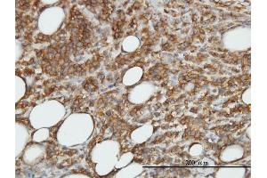 Immunostaining (ISt) image for anti-Calcium/calmodulin-Dependent Protein Kinase II beta (CAMK2B) (AA 1-503) antibody (ABIN560155)