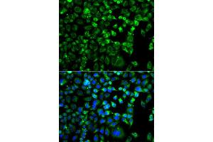 Immunofluorescence analysis of A549 cell using ZAK antibody. (ZAK 抗体)