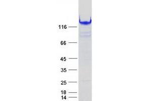 Validation with Western Blot