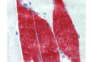Anti-TNNI / Troponin I Skeletal antibody IHC of human skeletal muscle. (Troponin I 抗体)