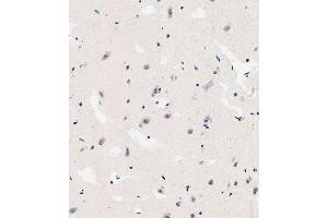 Immunohistochemical analysis of paraffin-embedded human brain tissue using (ABIN6242564 and ABIN6578912) performed on the Leica® BOND RXm. (TNIK 抗体  (Ser764))