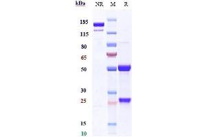 Anti-BST2 / CD317 Reference Antibody (XmAb 5592) on SDS-PAGE under reducing (R) condition.