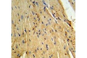 Phospholamban antibody IHC analysis in formalin fixed and paraffin embedded mouse heart tissue. (Phospholamban 抗体  (AA 1-30))