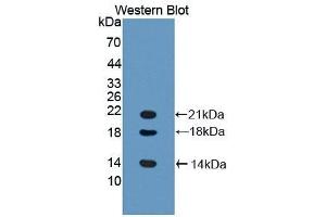 Detection of Recombinant LYAR, Mouse using Polyclonal Antibody to Ly1 Antibody Reactive Homolog (LYAR) (LYAR 抗体  (AA 270-388))