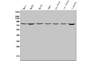 Western blot analysis of PNN/DRSP using anti-PNN/DRSP antibody (ABIN7600477).