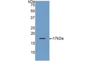 Detection of Recombinant GRN, Human using Polyclonal Antibody to Granulin (GRN) (Granulin 抗体  (AA 21-120))