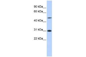 ING3 antibody used at 1 ug/ml to detect target protein. (ING3 抗体  (N-Term))