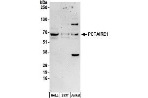anti-Cyclin-Dependent Kinase 16 (CDK16) (AA 25-75) antibody