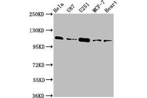 Western Blot Positive WB detected in: Hela whole cell lysate, U87 whole cell lysate, U251 whole cell lysate, MCF-7 whole cell lysate, Rat heart tissue All lanes: ANO2 antibody at 3. (Anoctamin 2 抗体  (AA 1-83))