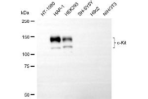 Western blotting analysis using c-kit antibody (ABIN7799335). (Recombinant KIT 抗体)