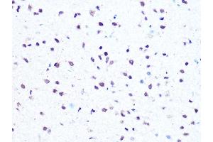 Immunohistochemistry (IHC) image for anti-High Mobility Group AT-Hook 1 (HMGA1) antibody (ABIN7267646)