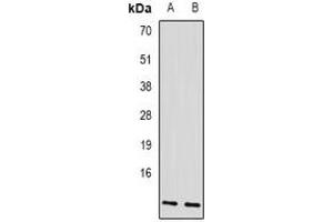 Western blot analysis of AP3-beta-1 expression in SKOV3 (A), mouse liver (B) whole cell lysates. (AP3B1 抗体)