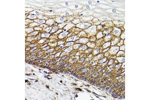 Immunohistochemistry of paraffin-embedded Human normal cervix using CD44 antibody  at dilution of 1:100 (40x lens). (CD44 抗体)