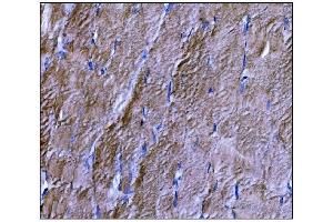 IHC analysis of Dysferlin/DYSF using anti-Dysferlin/DYSF antibody (ABIN7601939). (Dysferlin 抗体  (AA 51-747))