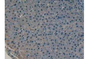 DAB staining on IHC-P; Samples: Human Liver Tissue (COLEC10 抗体  (AA 34-277))