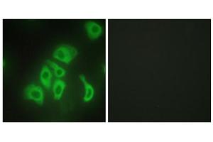 Immunofluorescence analysis of HepG2 cells, using TNF alpha antibody. (TNF alpha 抗体  (Internal Region))