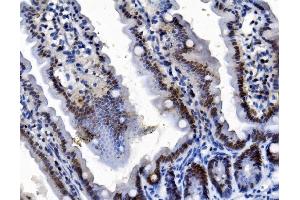IHC analysis of TMS1/ASC/PYCARD using anti-TMS1/ASC/PYCARD antibody (ABIN7601174).
