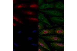 ABIN6264434 and ABIN6277935 staining  cells by IF/ICC. (PRMT7 抗体  (Internal Region))