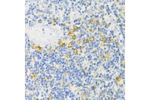 Immunohistochemistry of paraffin-embedded human tonsil using MLKL antibody (ABIN6134395, ABIN6143882, ABIN6143886 and ABIN6217454) at dilution of 1:100 (40x lens). (MLKL 抗体  (C-Term))