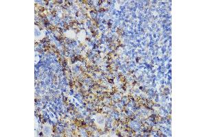 Immunohistochemistry of paraffin-embedded mouse spleen using CD152/CTLA-4 antibody (ABIN3022827, ABIN3022828, ABIN3022829 and ABIN6219247) at dilution of 1:250 (40x lens). (CTLA4 抗体  (AA 36-161))