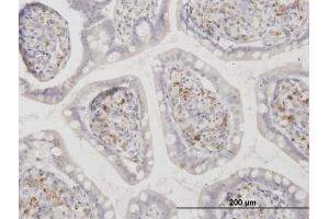 Immunoperoxidase of monoclonal antibody to ASAH1 on formalin-fixed paraffin-embedded human small Intestine. (ASAH1 抗体  (AA 25-124))