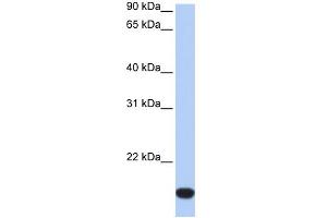 WB Suggested Anti-FLJ44894 Antibody Titration:  0. (FLJ44894 抗体  (Middle Region))