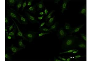 Immunofluorescence of monoclonal antibody to FBXL19 on HeLa cell. (FBXL19 抗体  (AA 365-472))