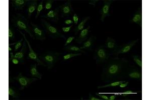 Immunofluorescence of monoclonal antibody to FBXL19 on HeLa cell.