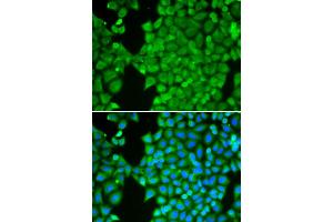 Immunofluorescence analysis of HeLa cells using CA3 antibody. (CA3 抗体)