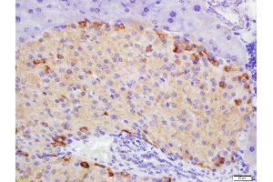 Formalin-fixed and paraffin embedded mouse pancreas labeled with Rabbit Anti-ATG1/ULK1 Polyclonal Antibody, Unconjugated 1:200 followed by conjugation to the secondary antibody and DAB staining (ULK1 抗体  (AA 951-1050))