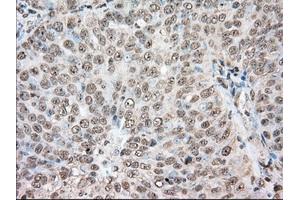 Immunohistochemical staining of paraffin-embedded Human colon tissue using anti-ACAT2 mouse monoclonal antibody. (ACAT2 抗体)