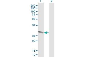 Western Blot analysis of PRSS1 expression in transfected 293T cell line by PRSS1 MaxPab polyclonal antibody. (PRSS1 抗体  (AA 1-247))