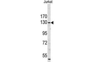 Western Blotting (WB) image for anti-Myosin IA (MYO1A) antibody (ABIN3003156) (Myosin IA 抗体)
