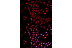 Immunofluorescence analysis of U2OS cells using KPNA4 antibody (ABIN5971058). (KPNA4 抗体)