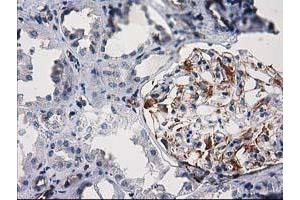 Immunohistochemical staining of paraffin-embedded Human Kidney tissue using anti-PDE2A mouse monoclonal antibody. (PDE2A 抗体)